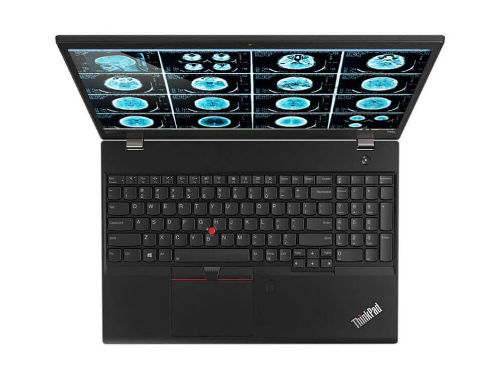 Lenovo 15 inch ThinkPad 3 edited